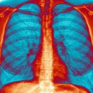 Udisanje bronhitis: ne samo moguće, ali je potrebno!