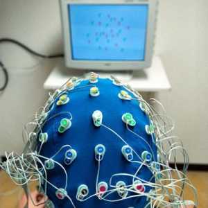 Elektroencefalografija - što je to? Kako je elektroencefalografija?