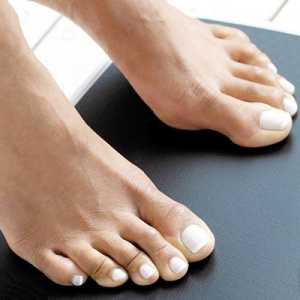 Atletsko stopalo: uzroci, simptomi i tretman