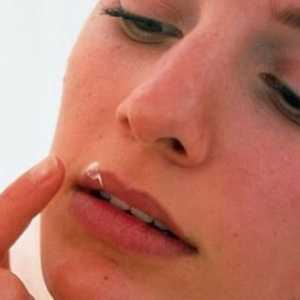 Kako da biste dobili osloboditi od hladno na usnama: spisak od najučinkovitijih metoda