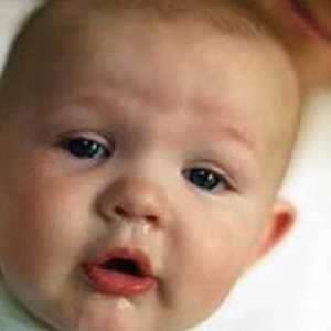 Kako tretirati curi nos u novorođenčeta?