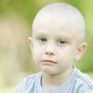Kako tretirati leukemije djeteta?