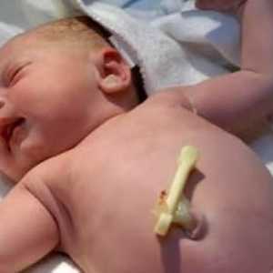 Kako rukovati pupka novorođenčeta ispravno i dosljedno