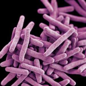 Kako odrediti tuberkuloze u ranoj fazi?