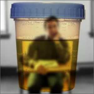 Kako proći test urina ispravno?