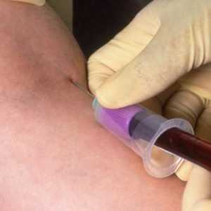 Kolika je stopa limfocita u krvi žena?