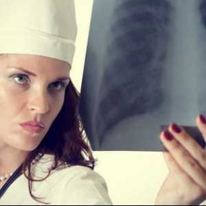 KKak liječenje bronhitisa kod kuće pomoću popularnih metoda i lijekova