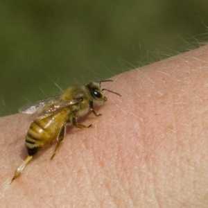 Konsultacije sa specijalistom: Što učiniti ako ujede pčela