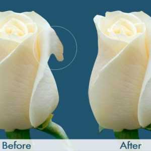 Labioplastika: prije i poslije. Komentar Cijene