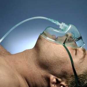 Tretman upale pluća kod odraslih: načela i droga
