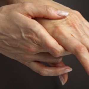 Medicina za zglobove - artritis lijek