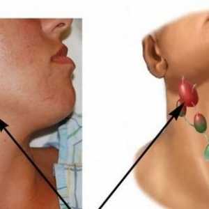 Limfnih čvorova u liječenju vrat i uzroci