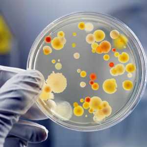 Mikroorganizam - je da u oblik života?