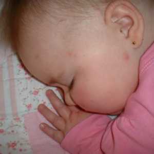 Školjke od bebe: uzroci, simptomi i tretmani