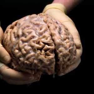 Ljudski mozak: struktura