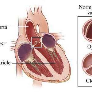 Aortne valvule 1, 2, 3 stupnja: znaci, simptomi, dijagnoza, liječenje
