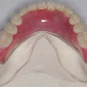 Najlon proteza u nedostatku zuba i parcijalne. Komentari o najlon proteza