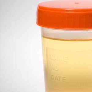 Stopa proteina u urinu