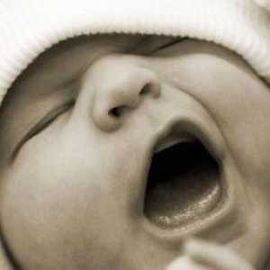 Mozak NDG novorođenčadi: dekodiranje, norme