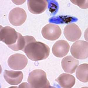 Glavni domaćin malarije. Životnog ciklusa, struktura, reprodukcije parazita