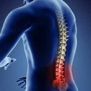 Akutna bol u leđima: Uzroci i tretman