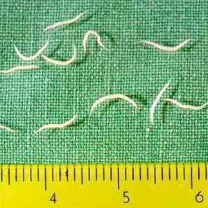 Pinworms u djece: simptomi. Tablete od pinworms za djecu. Dijete ima pinworms - šta da radim?