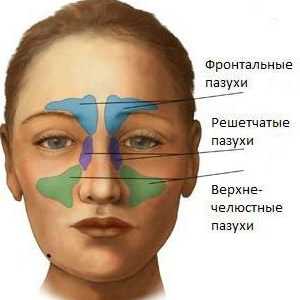 Akutni sinusitis: simptomi. Liječenje akutnog sinusitisa