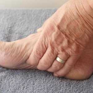 Oticanje nogu nakon loma noge: uzroci, liječenje. regenerativnoj medicini