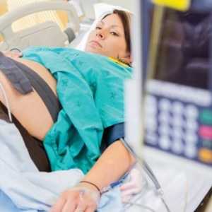 Odstupanja od norme "D-dimer" tokom trudnoće