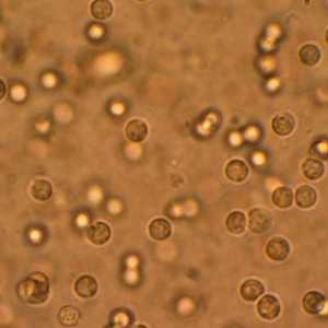 Patogenih bakterija u mokraći, šta to znači?