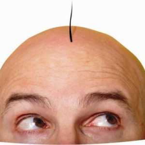 Transplantacija kose: mišljenja, cijene, fotografije