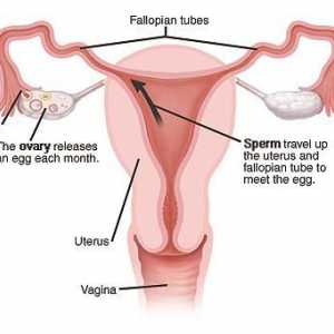 Podvezivanje jajovoda kod žena: implikacije. Ono što bi moglo biti posljedice podvezivanje jajovoda?