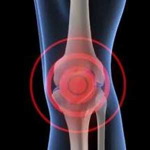 Zašto krcka koljena? Najčešći uzroci