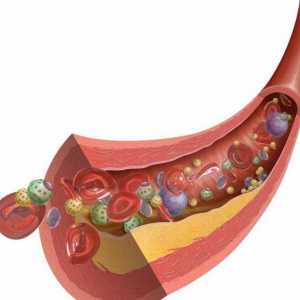 Zdrave namirnice koje smanjuju holesterol u krvi