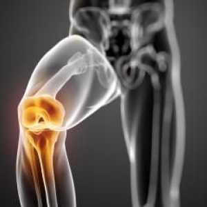 Posljedice povrede koljena. Protetika i rehabilitacija