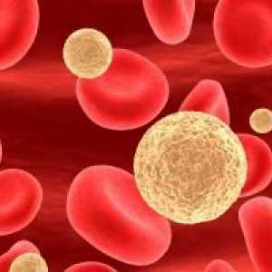 Povišen krvni limfociti u djece: Što trebate znati?