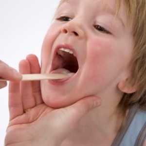 Odgovarajući tretman kod djece adenoiditis