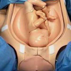 Pravilan položaj fetusa - uzdužni