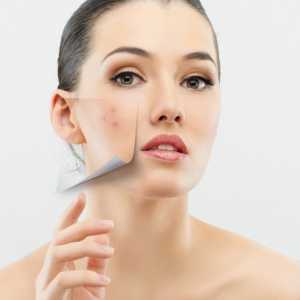Uzrok Interna bubuljice na licu. Kako ukloniti unutrašnje akni na licu?