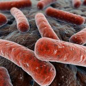 Uzroci i glavne karakteristike plućne tuberkuloze kod odraslih