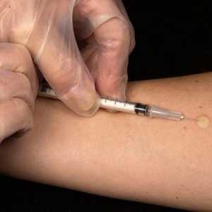 Vakcinacija Manta norma, abnormalnosti
