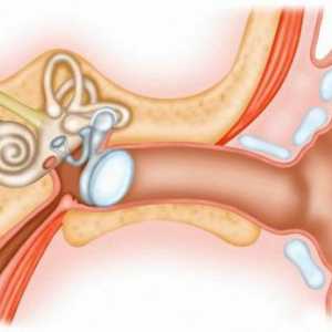 Uključite utikač u uho: simptomi, načina za uklanjanje