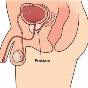 Prostate - je ... prostate Masaža: Prednosti