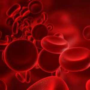Rak krvi: simptomi kod žena. Simptomi raka krvi kod odraslih