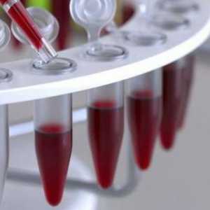 Dešifrovanju HCT stopa test krvi