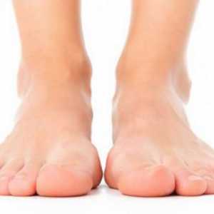 Rossolimo je znak - patoloških refleksa, očituje u fleksiji prstiju stopala ili četke