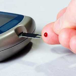 Rejting glukometara. Kako odabrati metar glukoze u krvi? Pregled glukometara