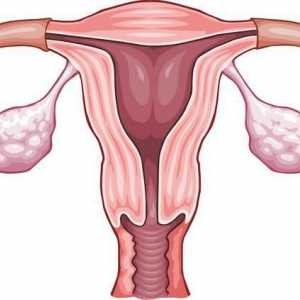 Retrodeviation maternice: Uzroci i tretman