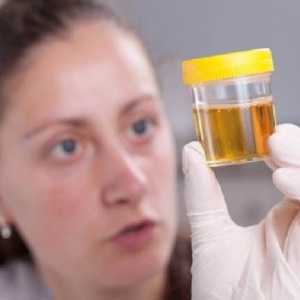 Zašto je oblačno urina kod djece?