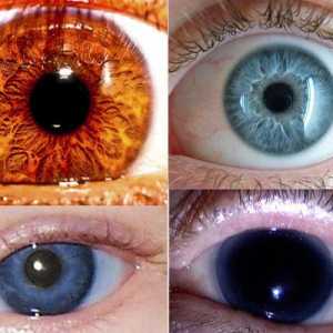 Najrjeđih boja očiju - što je to?